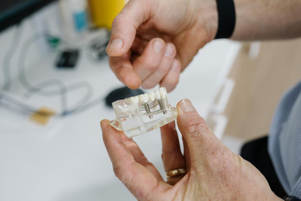 dental implant near me | dental implant model