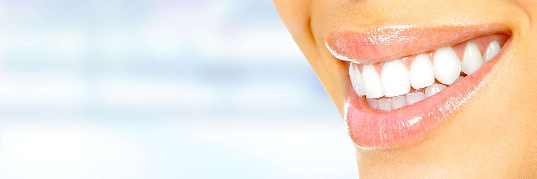 Woman smiling with brilliantly white teeth