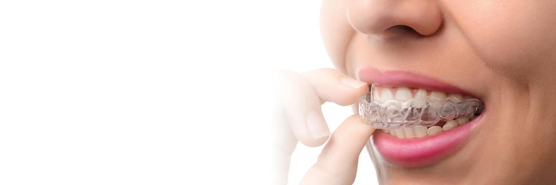 cosmetic dentist in coffs harbour 