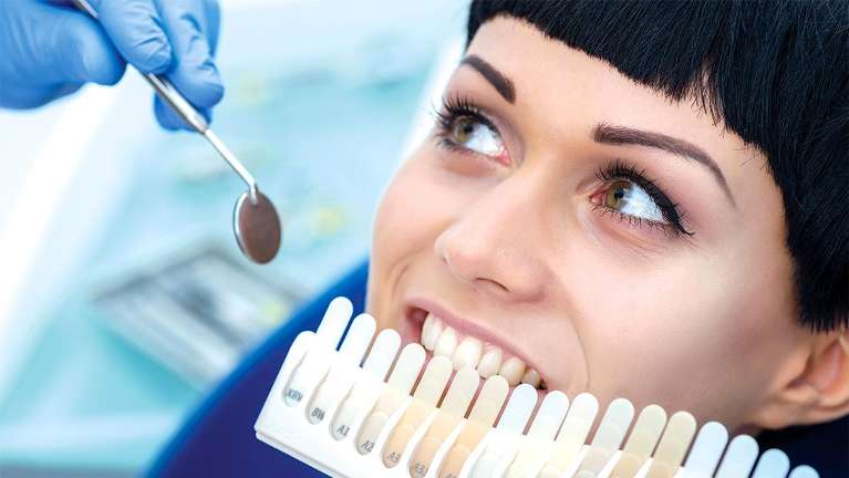 Veneer shades being shown to a patient