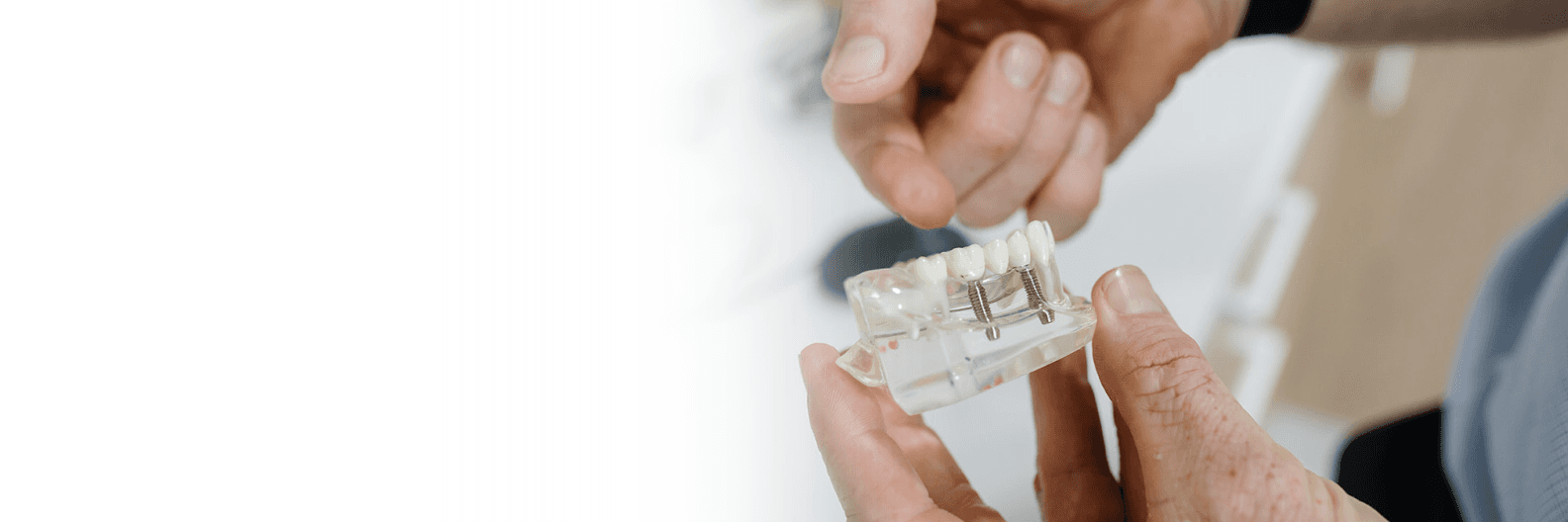 Dental Implants in Coffs Harbour, NSW